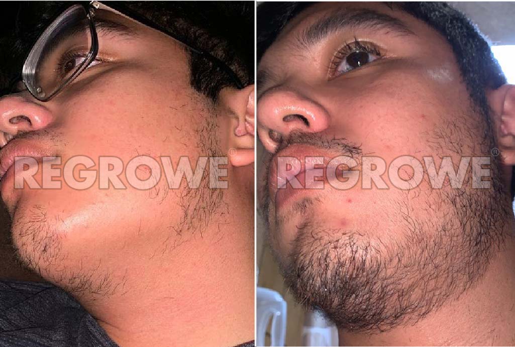 antes%20y%20despues2 17