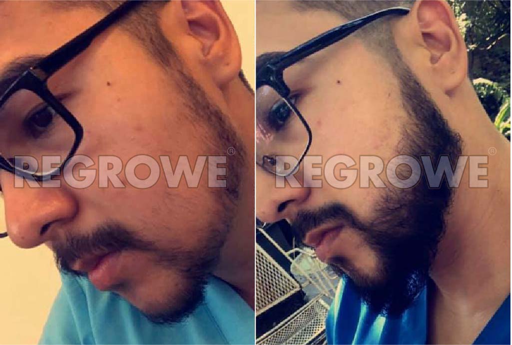 antes%20y%20despues2.1 17